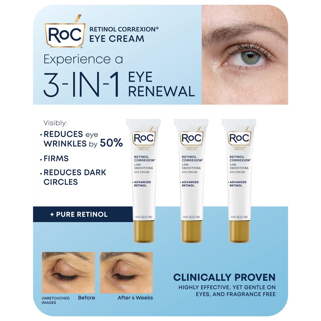 RoC Line Smoothing Eye Cream, 3-Pack (0.6 fl oz each)
